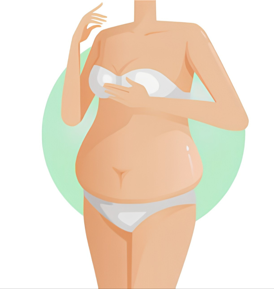 Illustrated body shape before a mommy makeover